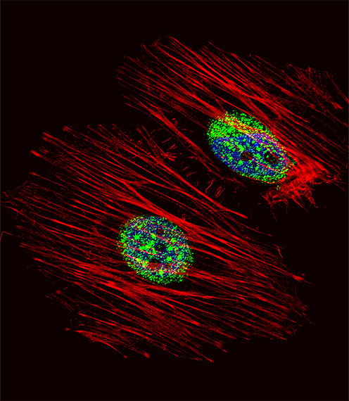 Fluorescent confocal image of Hela cell stained with NME2 Antibody (N-term)(Cat#AP8081a).Hela cells were fixed with 4% PFA (20 min), permeabilized with Triton X-100 (0.1%, 10 min), then incubated with NME2 primary antibody (1:25, 1 h at 37?). For secondary antibody, Alexa Fluor� 488 conjugated donkey anti-rabbit antibody (green) was used (1:400, 50 min at 37?).Cytoplasmic actin was counterstained with Alexa Fluor� 555 (red) conjugated Phalloidin (7units/ml, 1 h at 37?). Nuclei were counterstained with DAPI (blue) (10 �g/ml, 10 min). NME2 immunoreactivity is localized to Cytoplasm and Nucleus significantly.
