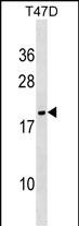 NME6 Antibody (N-term) (Cat. #AP8083a) western blot analysis in T47D cell line lysates (35ug/lane).This demonstrates the NME6 antibody detected the NME6 protein (arrow).