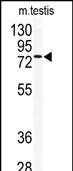 Western blot analysis of anti-TLK2 Antibody (Center) (Cat.#AP8102c) in mouse testis tissue lysates (35ug/lane).TLK2(arrow) was detected using the purified Pab.