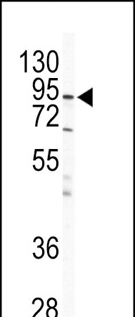 WB - IKK beta Antibody AP8109a