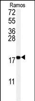 WB - UBC9 Antibody AM1261a