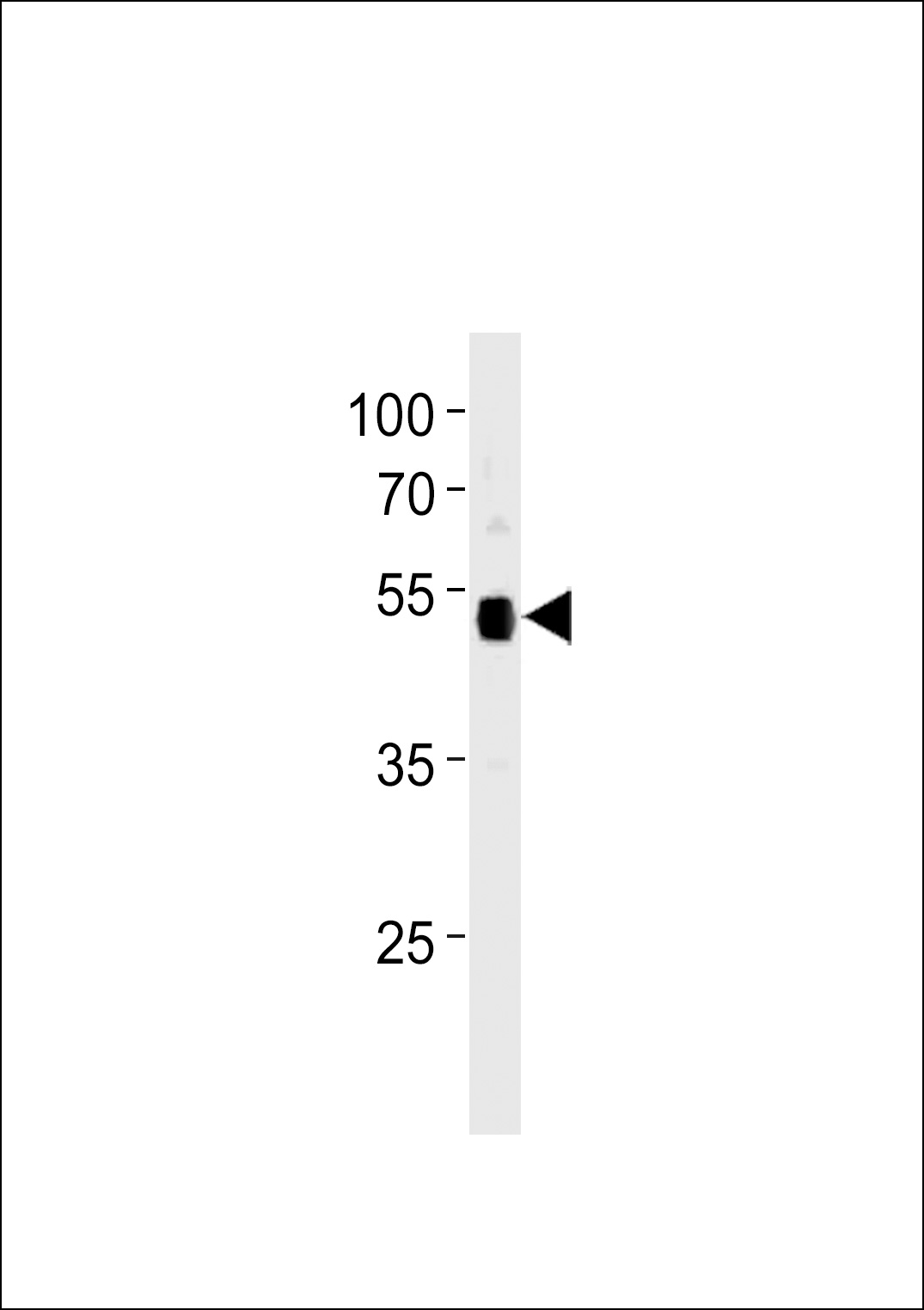 TP53 Antibody (C-term) (Cat. #AP2505b) western blot analysis in 293 cell line lysates (35ug/lane).This demonstrates the TP53 antibody detected the TP53 protein (arrow).