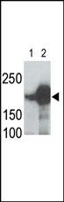 LRP5  Antibody (C-term)(Cat. #AP6157a) is used in Western blot to detect recombinant human LRP5 (Lane 1) and mouse LRP5 (Lane 2) proteins in transfected 293 cell lysates. Data is kindly provided by Drs. V. Harris and S. Aaronson from the Mount Sinai School of Medicine (New York, NY).