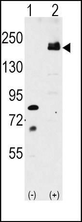 WB - LRP6 Antibody (C-term T1546) AP6158a