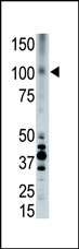 The anti-LRP8 Pab (Cat. #AP6159a) is used in Western blot to detect LRP8 in placenta cell lysate.