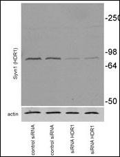 WB - SYVN1 (HRD1) Antibody (C-term) AP2184A