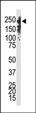 The anti-Dnmt1 C-term Pab (Cat. #AP1032a) is used in Western blot to detect Dnmt1 in Jurkat cell lysate.