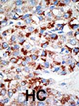 IHC-P - UBE1C Antibody (C-term) AP1063b