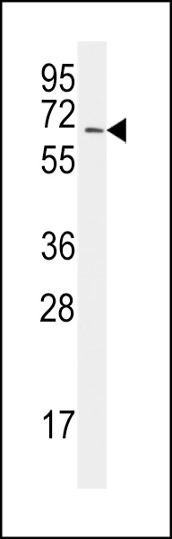 The anti-UBA2 C-term E616 Antibody (Cat.#AP1065b) is used in Western blot to detect  UBA2 in Jurkat lysate.