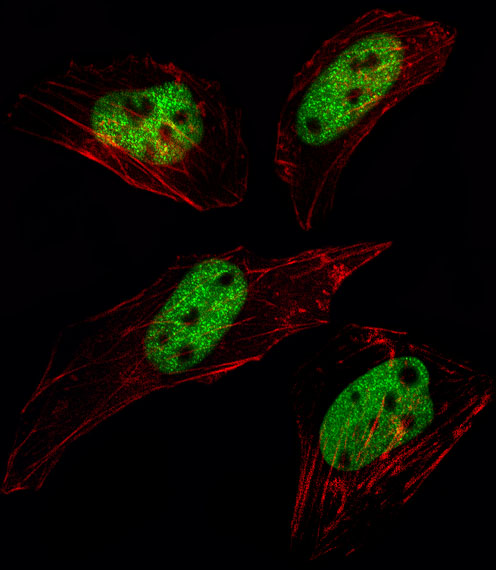 Fluorescent image of Hela cell stained with SUMO1 Antibody (N-term E67)(Cat#AP1222d/SH030609A).Hela cells were fixed with 4% PFA (20 min), permeabilized with Triton X-100 (0.1%, 10 min), then incubated with SUMO1 primary antibody (1:25, 1 h at 37?). For secondary antibody, Alexa Fluor� 488 conjugated donkey anti-rabbit antibody (green) was used (1:400, 50 min at 37?).Cytoplasmic actin was counterstained with Alexa Fluor� 555 (red) conjugated Phalloidin (7units/ml, 1 h at 37?). SUMO1 immunoreactivity is localized to Nucleus significantly.