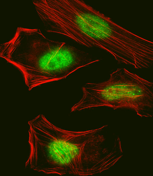 Fluorescent confocal image of Hela cell stained with Pan SUMO Antibody(Cat#AP1290a).Hela cells were fixed with 4% PFA (20 min), permeabilized with Triton X-100 (0.1%, 10 min), then incubated with Pan SUMO primary antibody (1:25, 1 h at 37?). For secondary antibody, Alexa Fluor� 488 conjugated donkey anti-rabbit antibody (green) was used (1:400, 50 min at 37?).Cytoplasmic actin was counterstained with Alexa Fluor� 555 (red) conjugated Phalloidin (7units/ml, 1 h at 37?). Nuclei were counterstained with DAPI (blue) (10 �g/ml, 10 min).Pan SUMO immunoreactivity is localized to Nucleus significantly.