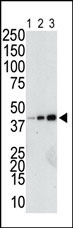 The anti-GST Pab (Cat. #AP1298a) is used in Western blot to detect a GST-fusion recombinant protein (42 kDa) purified from bacterial lysate (Lanes 1-3: 10, 40, and 160 ng GST-fusion protein).
