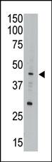 The anti-CEM15 Pab (Cat. #AP1351b) is used in Western blot to detect CEM15 in A549 cell lysate.