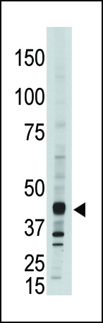 The anti-CEM15 Pab (Cat. #AP1351d) is used in Western blot to detect CEM15 in A375  cell lysate.