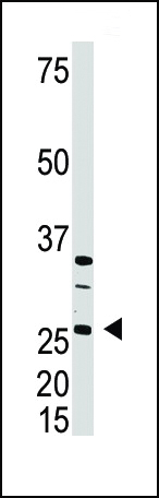 The anti-DKK4 C-term Pab (Cat. #AP1524b) is used in Western blot to detect DKK4 in A375  cell lysate.
