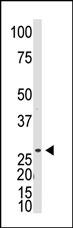 WB - DKKL1 Antibody (C-term) AP1525b