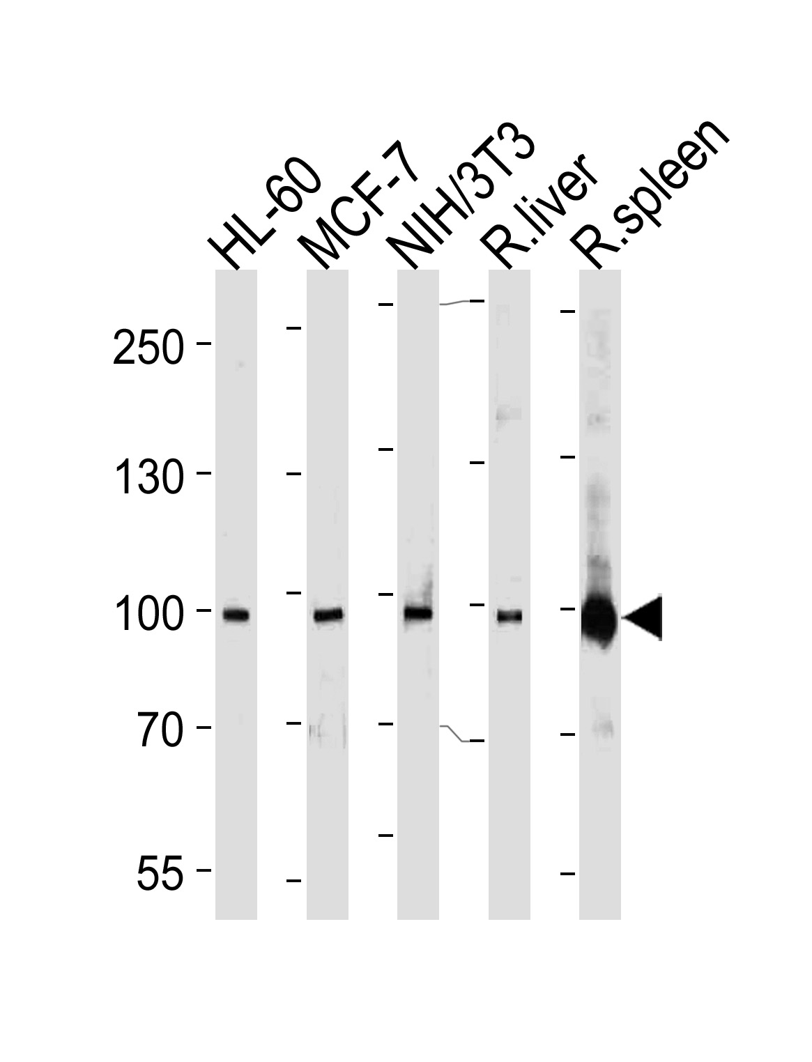 STAT5b Antibody (Cat. #AP1530a) western blot analysis in HL-60,MCF-7,mouse NIH/3T3 cell line, rat liver and spleen lysates (35ug/lane).This demonstrates the STAT5b antibody detected the STAT5b protein (arrow).