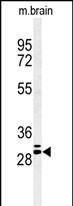 Western blot analysis of hGJB2-C218.Connexin (Cat. #AP1542a) in mouse brain tissue lysates (35ug/lane). GJB2 (arrow) was detected using the purified Pab.