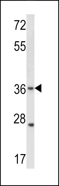 Western blot analysis of hGJB3-C241 (Cat. #AP1543b) in WiDr cell line lysates (35ug/lane). GJB3 (arrow) was detected using the purified Pab.(2ug/ml)