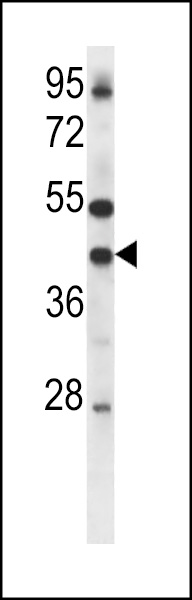GJA4 Antibody (K317).Connexin (Cat. #AP1544b) western blot analysis in mouse lung tissue lysates (35ug/lane).This demonstrates the GJA4 antibody detected the GJA4 protein (arrow).