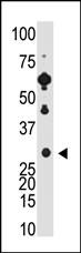 The anti-Recoverin C-term Pab (Cat. #AP1565b) is used in Western blot to detect Recoverin in Y79 cell lysate.