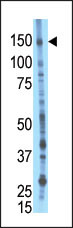 The anti-Bike C-term Pab (Cat. #AP1723a) is used in Western blot to detect Bike in mouse liver tissue lysate.