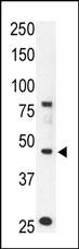 The anti-CCBP2 N-term Pab (Cat. #AP2012a) is used in Western blot to detect CCBP2 in mouse liver tissue lysate.