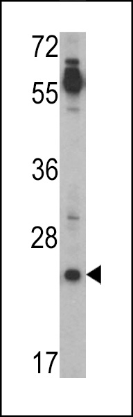 Western blot analysis of CRIPTO (TDGF1) Antibody (N-term) (Cat. #AP2047a) in Jurkat cell line lysates (35ug/lane). TDGF1 (arrow) was detected using the purified Pab.