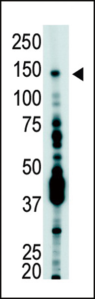 The anti-USP7 Pab (Cat. #AP2136b) is used in Western blot to detect USP7 in T-47D cell lysate.