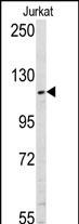 Western blot analysis of anti-USP11 Pab (Cat. #AP2139a) in Jurkat cell line lysates (35ug/lane). USP11(arrow) was detected using the purified Pab.