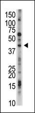 The anti-USP12 Pab (Cat. #AP2140a) is used in Western blot to detect USP12 in mouse kidney tissue lysate.