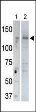 The anti-USP25 C-term Pab (Cat. #AP2150b) is used in Western blot to detect USP25 in rat testis tissue lysate (lane 1) and USP25-transfected HeLa cell lysates (lane 2). Transfection data is kindly provided by Dr. B. Pierrat from the Novartis Institute for Biomedical Research (Basel, Switzerland).