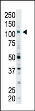 The anti-EPS15R Pab (Cat. #AP2160a) is used in Western blot to detect EPS15R in Y79 cell lysate.