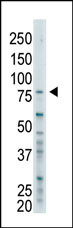 The anti-BAP1 Pab (Cat. #AP2168b) is used in Western blot to detect BAP1 in SK-BR-3 cell lysate.