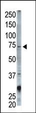 The anti-STAM Pab (Cat. #AP2180a) is used in Western blot to detect STAM in mouse cerebellum tissue lysate.