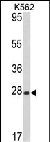 Western blot analysis of hARL1-G3 (Cat. #AP2304a) in K562 cell line lysates (35ug/lane). ARL1 (arrow) was detected using the purified Pab.