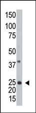 Western blot analysis of anti-hARL3 -M1 Pab (Cat. #AP2306a) in A2058 cell line lysate (35ug/lane). hARL3 -M1(arrow) was detected using the purified Pab.