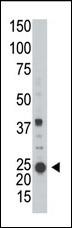 Western blot analysis of anti-ARL3 (Cat. #AP2306b) in A2058 cell line lysate (35ug/lane).ARL3 (arrow) was detected using the purified Pab.