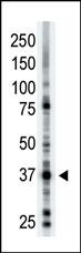 The anti-ART1 Pab (Cat. #AP2311a) is used in Western blot to detect ART1 in mouse brain tissue lysate.