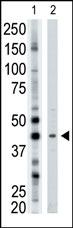 The anti-ART3 Pab (Cat. #AP2312a) is used in Western blot to detect ART3 in mouse brain tissue lysate.