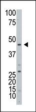 Western blot analysis of ART3 Antibody (C-term) in HL60 cell line lysates (25ug/lane). ART3(arrow) was detected using the purified Pab (4 ug/ml).