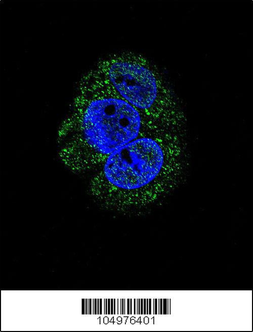 Confocal immunofluorescent analysis of AGL Antibody (Center)(Cat#AP2402a) with HepG2 cell followed by Alexa Fluor 488-conjugated goat anti-rabbit lgG (green). DAPI was used to stain the cell nuclear (blue).