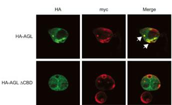 Expression of myc-GS causes wild type but not the ÄCBD mutant of AGL to aggregate around the PAS-stain-positive inclusions. HepG2 cells were transfected with either HA-tagged wild-type AGL (HA-AGL) or HA-AGL ÄCBD. Cells were fixed in formalin and processed for IF using anti-HA (green) and anti-myc (red) antibodies. White arrows indicate colocalization of HA-AGL and myc-GS.