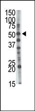 WB - GCNT1 Antibody (Center) AP2404a