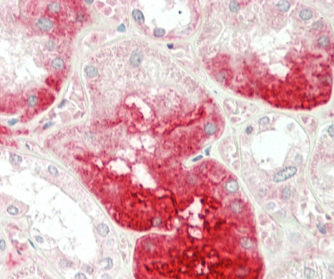 IHC-P - MGAT3 Antibody (N-term) AP2411a