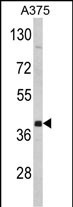 Western blot analysis of hFNTA-A345 (Cat. #AP2420b) in A375 cell line lysates (35ug/lane). FNTA (arrow) was detected using the purified Pab.