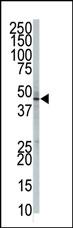 The anti-GPI8 Pab (Cat. #AP2462a) is used in Western blot to detect GPI8 in 293 cell lysate.