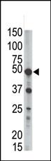 The anti-GPI8 Pab (Cat. #AP2462b) is used in Western blot to detect GPI8 in mouse liver tissue lysate.