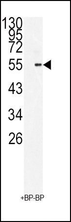 Western blot analysis of BMI1 Antibody (C-term) antibody(Cat. #AP2513b) in 293 cell line lysates (35ug/lane). BMI1(arrow) was detected using the purified Pab.