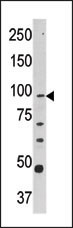 Western blot analysis of anti-CPT1A Pab (Cat. #AP2524b) in Y79 cell line lysate (35ug/lane). CPT1A(arrow) was detected using the purified Pab.